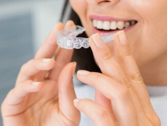 Invisalign pris
