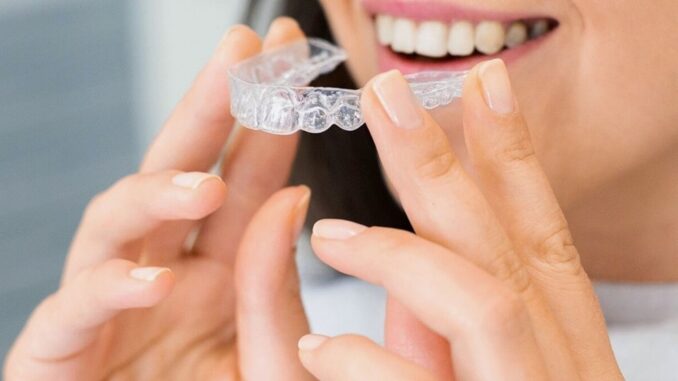 Invisalign pris