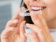 Invisalign pris